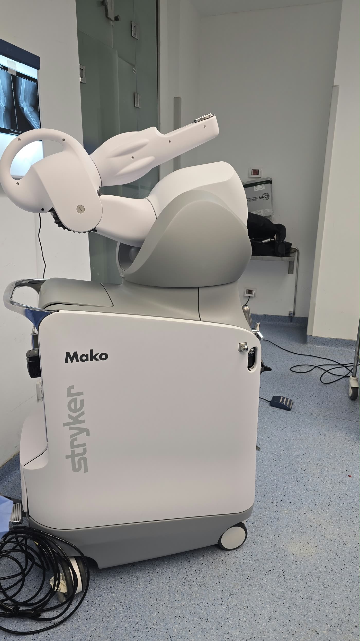 The Mako arm positioned for a real knee replacement case, with the patient's pre-operative imaging on display.